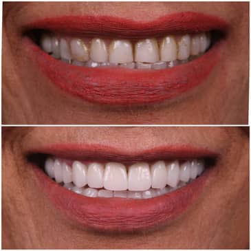 Slider image (2) Odonto Liuzzi